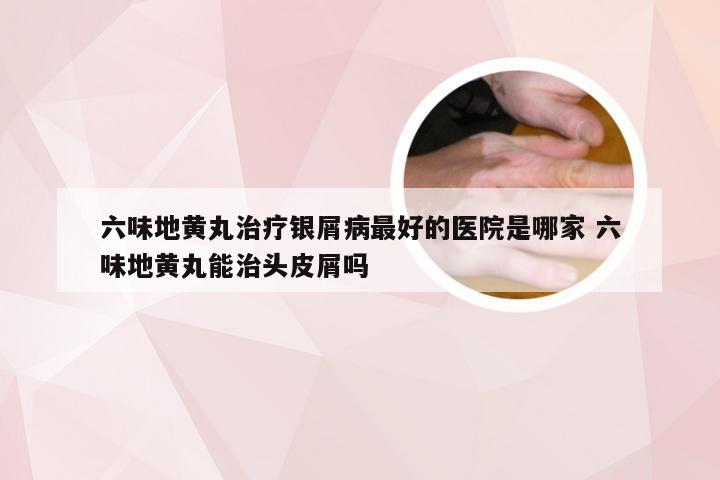 六味地黄丸治疗银屑病最好的医院是哪家 六味地黄丸能治头皮屑吗