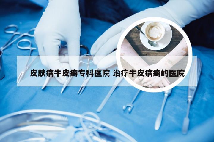 皮肤病牛皮癣专科医院 治疗牛皮病癣的医院