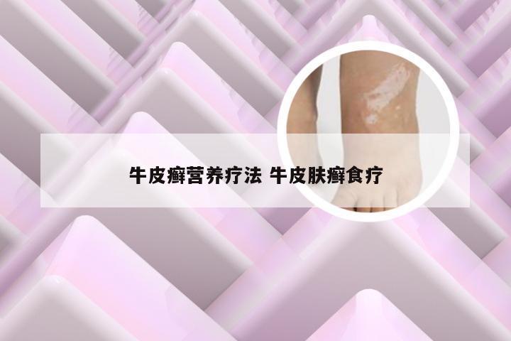 牛皮癣营养疗法 牛皮肤癣食疗