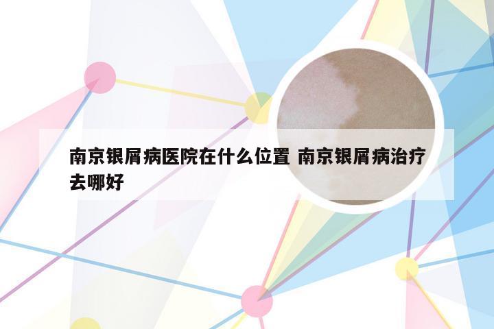 南京银屑病医院在什么位置 南京银屑病治疗去哪好