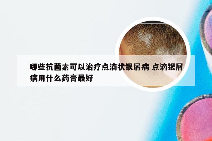 哪些抗菌素可以治疗点滴状银屑病 点滴银屑病用什么药膏最好