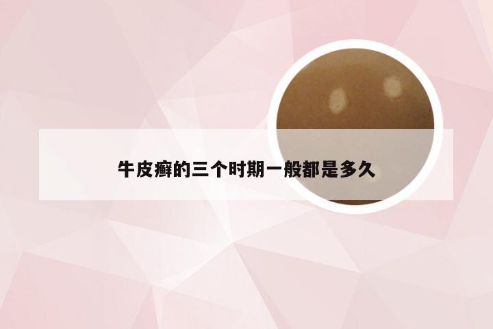 牛皮癣的三个时期一般都是多久