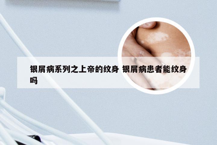 银屑病系列之上帝的纹身 银屑病患者能纹身吗