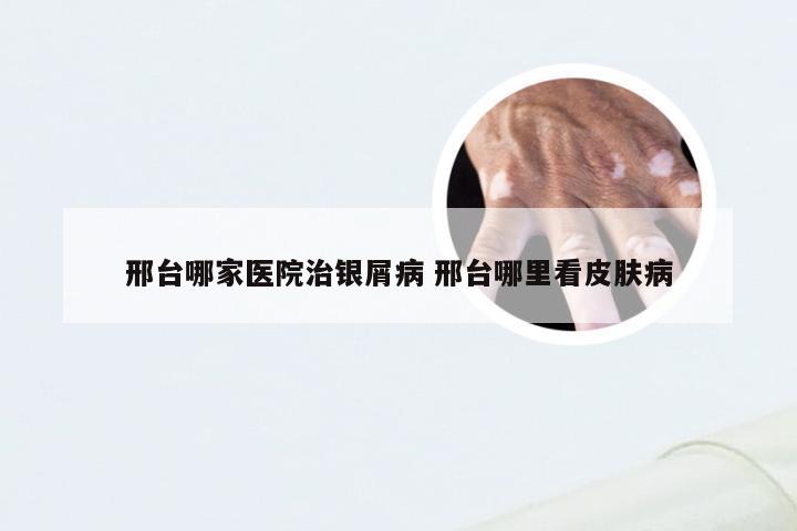 邢台哪家医院治银屑病 邢台哪里看皮肤病