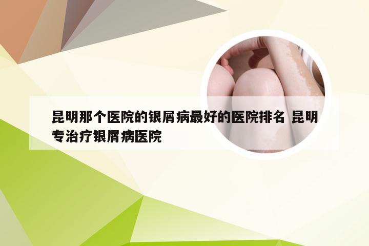 昆明那个医院的银屑病最好的医院排名 昆明专治疗银屑病医院