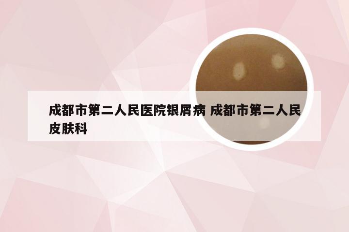 成都市第二人民医院银屑病 成都市第二人民皮肤科