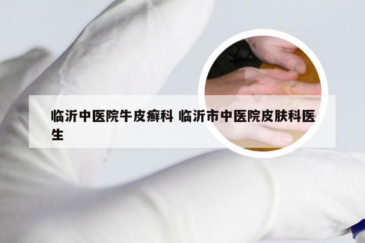 临沂中医院牛皮癣科 临沂市中医院皮肤科医生