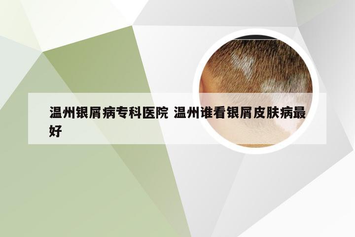 温州银屑病专科医院 温州谁看银屑皮肤病最好