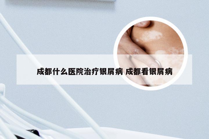 成都什么医院治疗银屑病 成都看银屑病