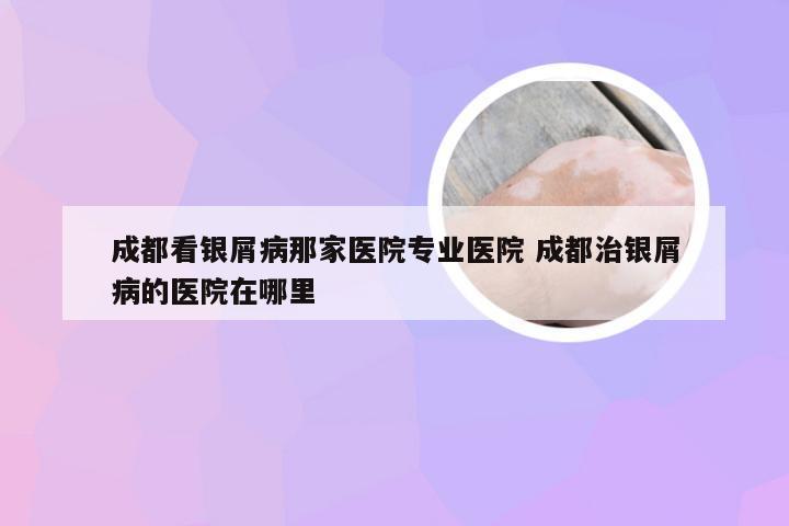 成都看银屑病那家医院专业医院 成都治银屑病的医院在哪里