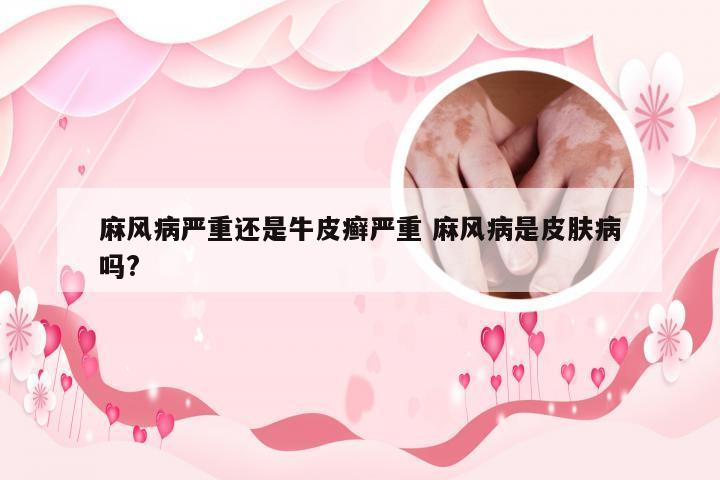 麻风病严重还是牛皮癣严重 麻风病是皮肤病吗?