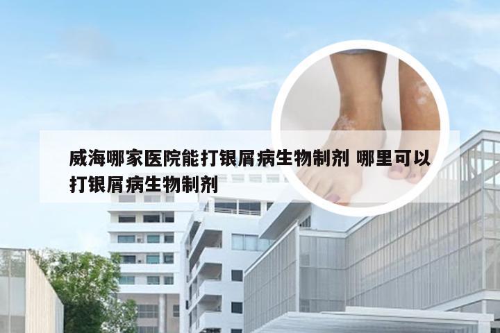威海哪家医院能打银屑病生物制剂 哪里可以打银屑病生物制剂