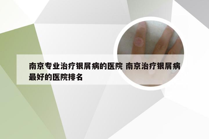 南京专业治疗银屑病的医院 南京治疗银屑病最好的医院排名