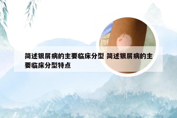 简述银屑病的主要临床分型 简述银屑病的主要临床分型特点