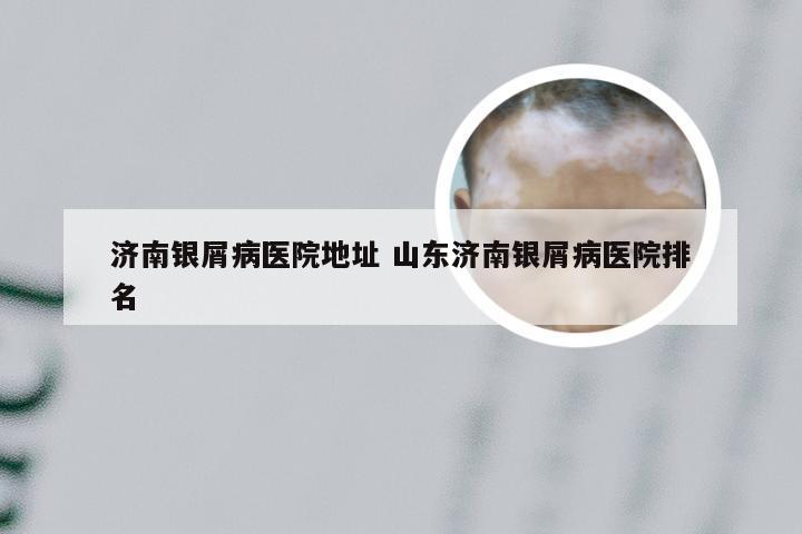 济南银屑病医院地址 山东济南银屑病医院排名