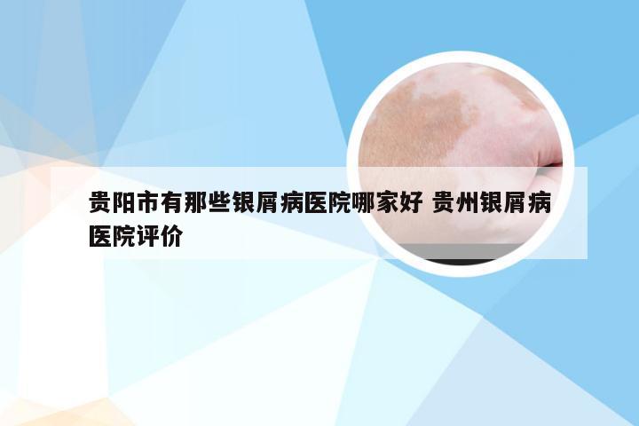 贵阳市有那些银屑病医院哪家好 贵州银屑病医院评价