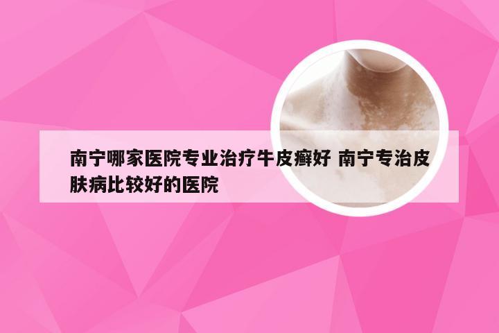 南宁哪家医院专业治疗牛皮癣好 南宁专治皮肤病比较好的医院