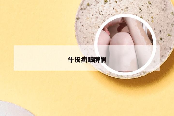 牛皮癣跟脾胃