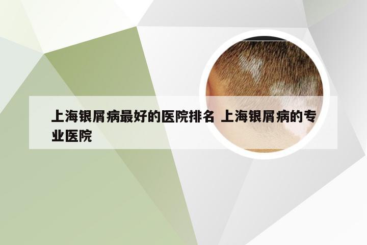 上海银屑病最好的医院排名 上海银屑病的专业医院