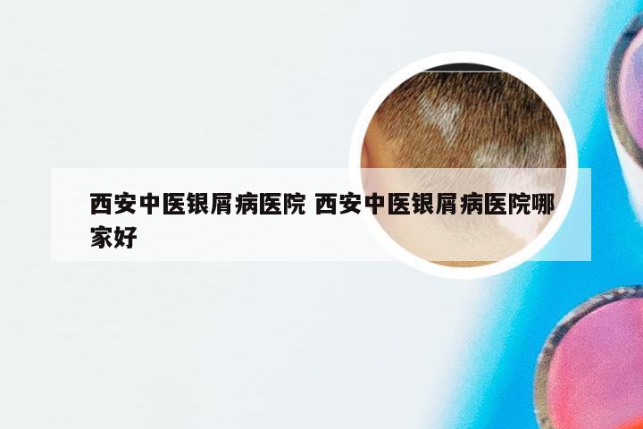 西安中医银屑病医院 西安中医银屑病医院哪家好