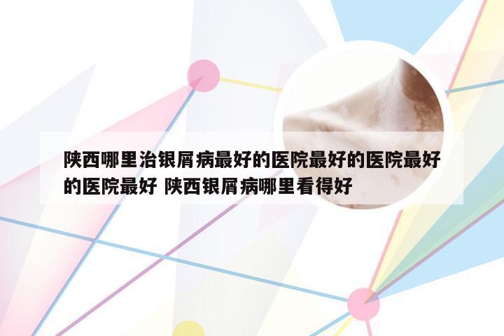 陕西哪里治银屑病最好的医院最好的医院最好的医院最好 陕西银屑病哪里看得好