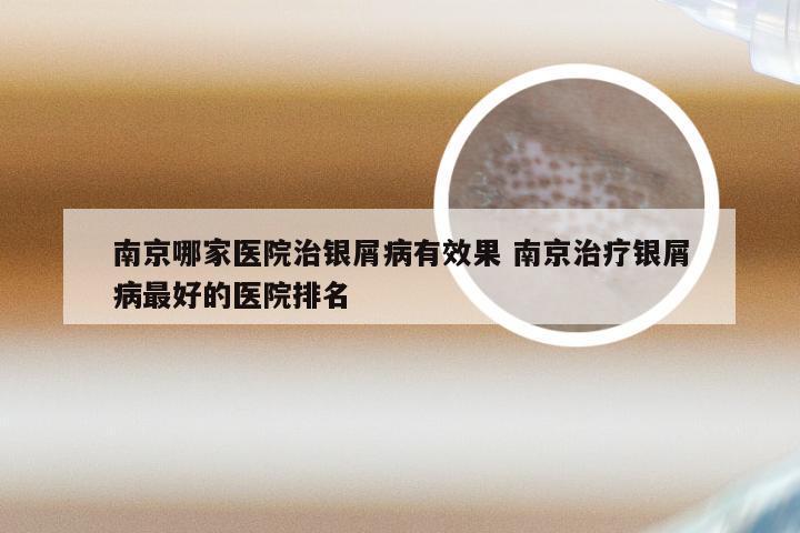 南京哪家医院治银屑病有效果 南京治疗银屑病最好的医院排名