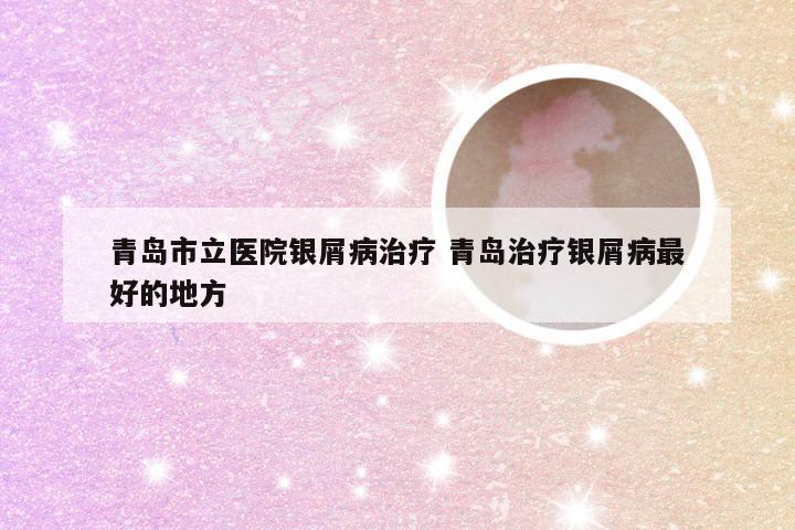 青岛市立医院银屑病治疗 青岛治疗银屑病最好的地方