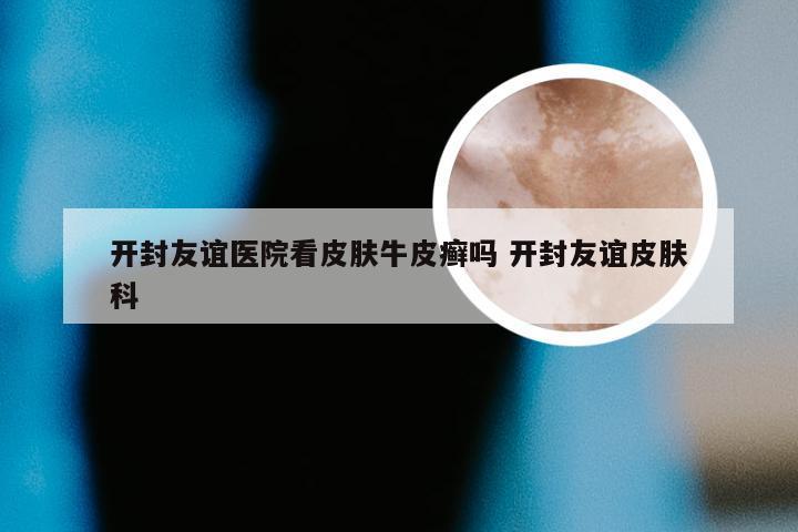 开封友谊医院看皮肤牛皮癣吗 开封友谊皮肤科
