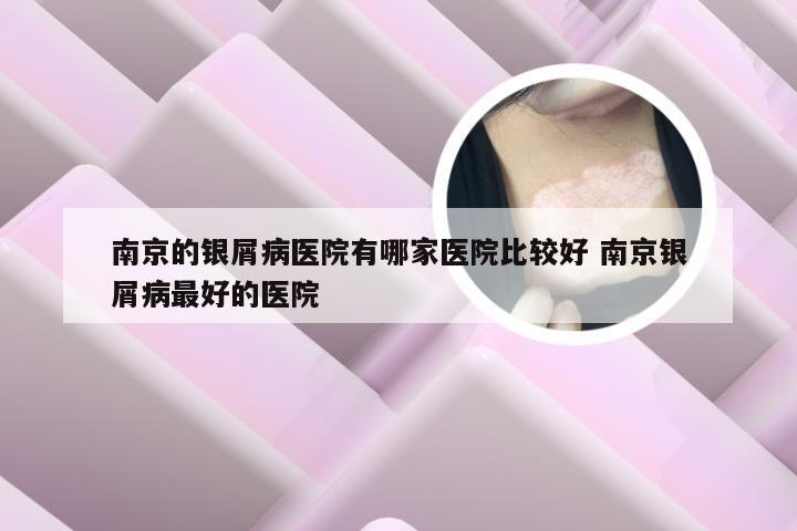 南京的银屑病医院有哪家医院比较好 南京银屑病最好的医院