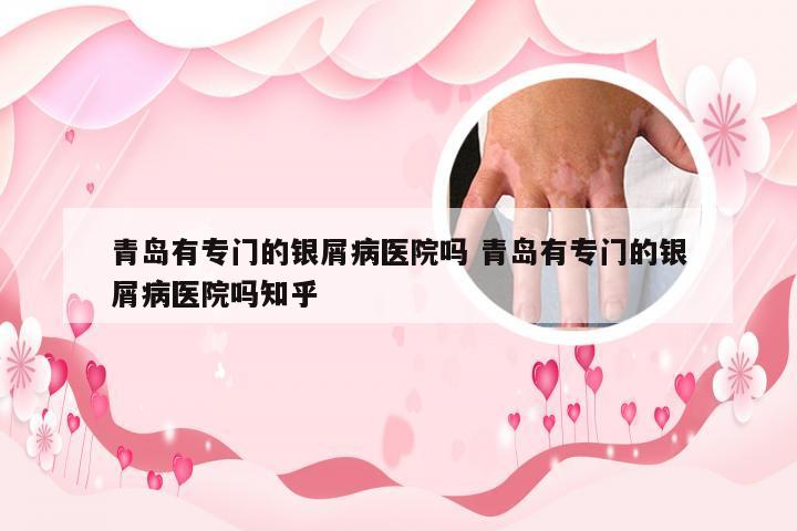 青岛有专门的银屑病医院吗 青岛有专门的银屑病医院吗知乎