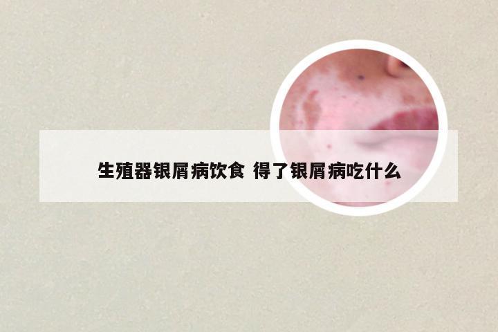 生殖器银屑病饮食 得了银屑病吃什么