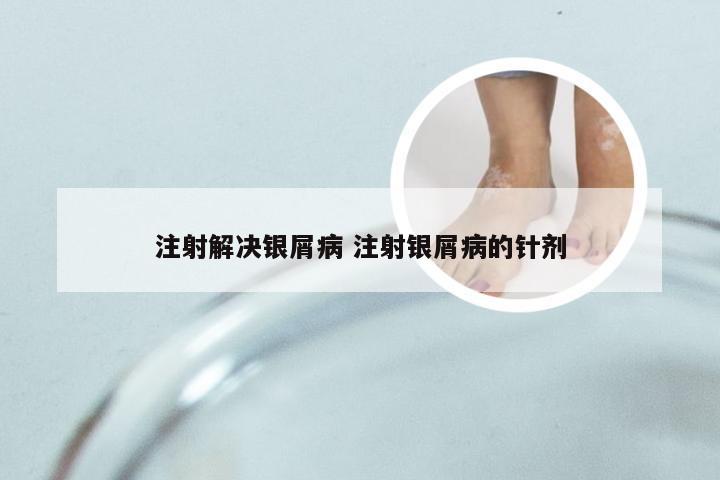 注射解决银屑病 注射银屑病的针剂