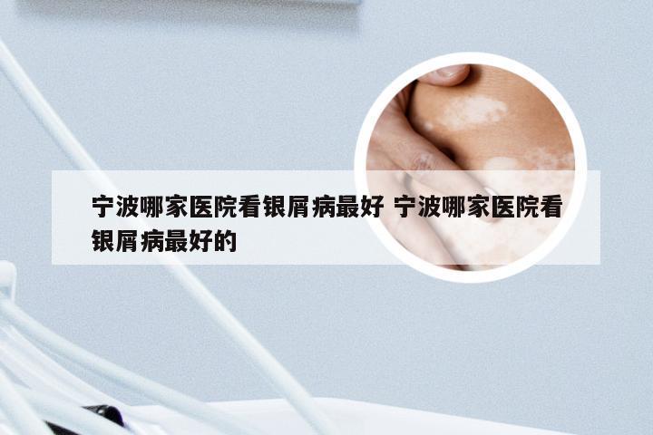 宁波哪家医院看银屑病最好 宁波哪家医院看银屑病最好的