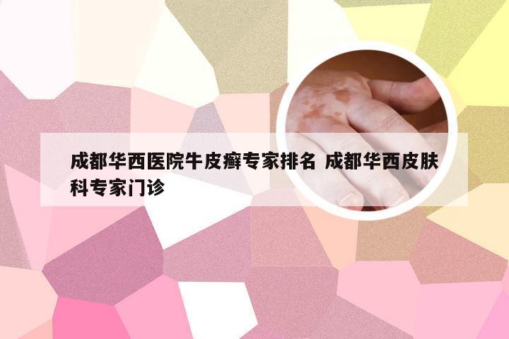成都华西医院牛皮癣专家排名 成都华西皮肤科专家门诊