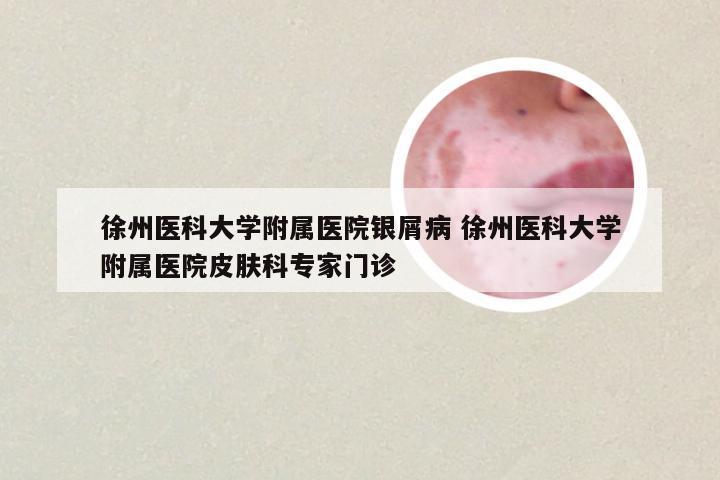 徐州医科大学附属医院银屑病 徐州医科大学附属医院皮肤科专家门诊