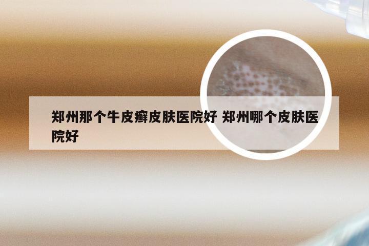 郑州那个牛皮癣皮肤医院好 郑州哪个皮肤医院好
