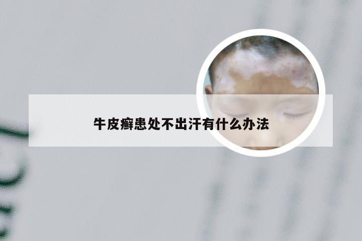 牛皮癣患处不出汗有什么办法