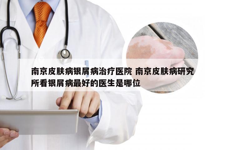 南京皮肤病银屑病治疗医院 南京皮肤病研究所看银屑病最好的医生是哪位