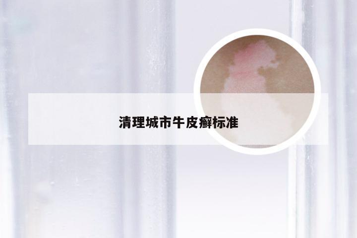 清理城市牛皮癣标准