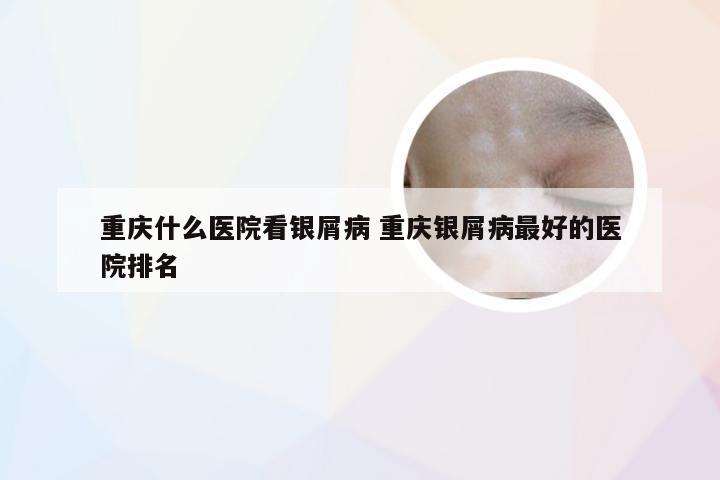 重庆什么医院看银屑病 重庆银屑病最好的医院排名
