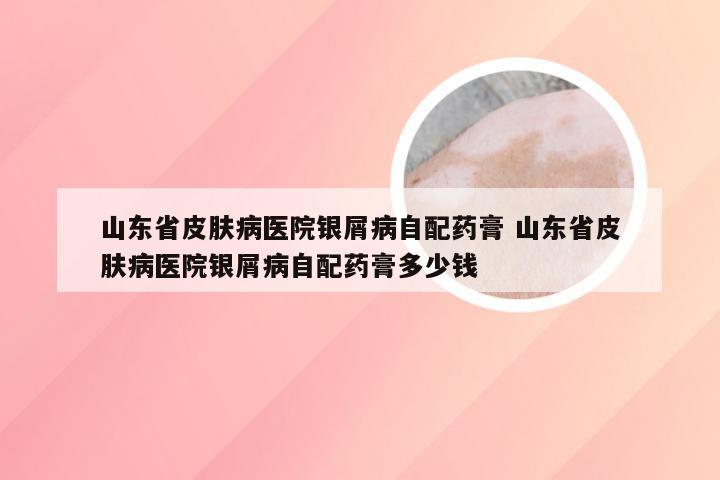 山东省皮肤病医院银屑病自配药膏 山东省皮肤病医院银屑病自配药膏多少钱