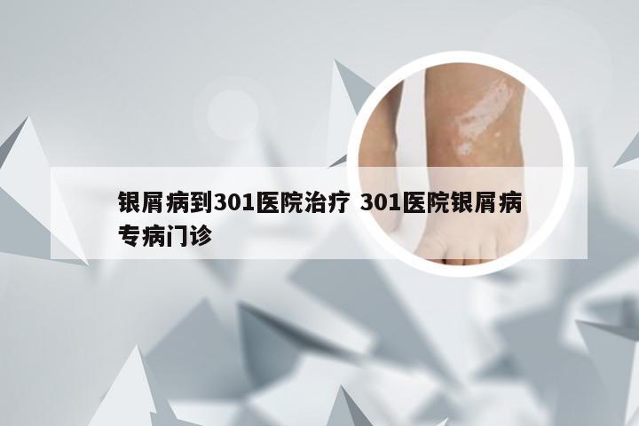 银屑病到301医院治疗 301医院银屑病专病门诊