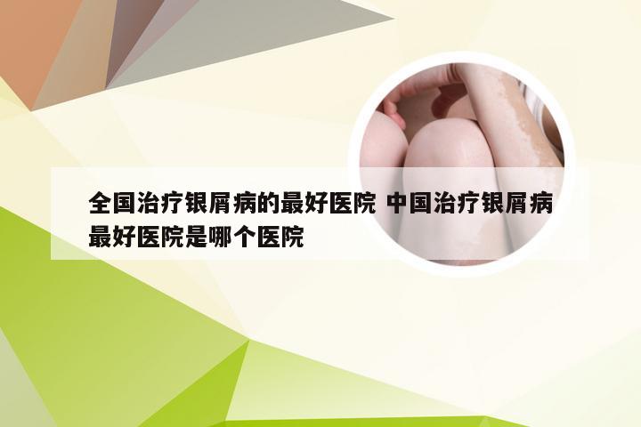 全国治疗银屑病的最好医院 中国治疗银屑病最好医院是哪个医院