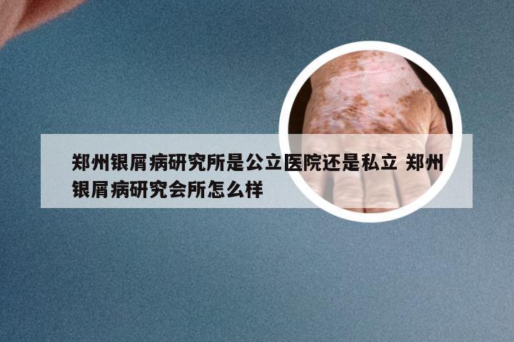 郑州银屑病研究所是公立医院还是私立 郑州银屑病研究会所怎么样