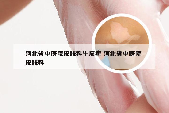 河北省中医院皮肤科牛皮癣 河北省中医院 皮肤科