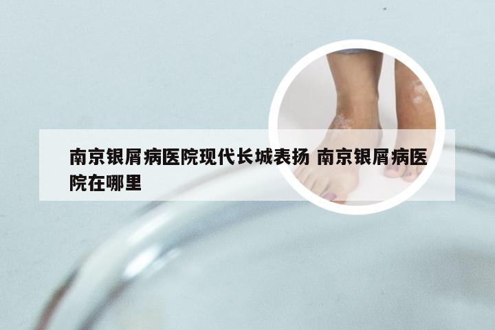 南京银屑病医院现代长城表扬 南京银屑病医院在哪里