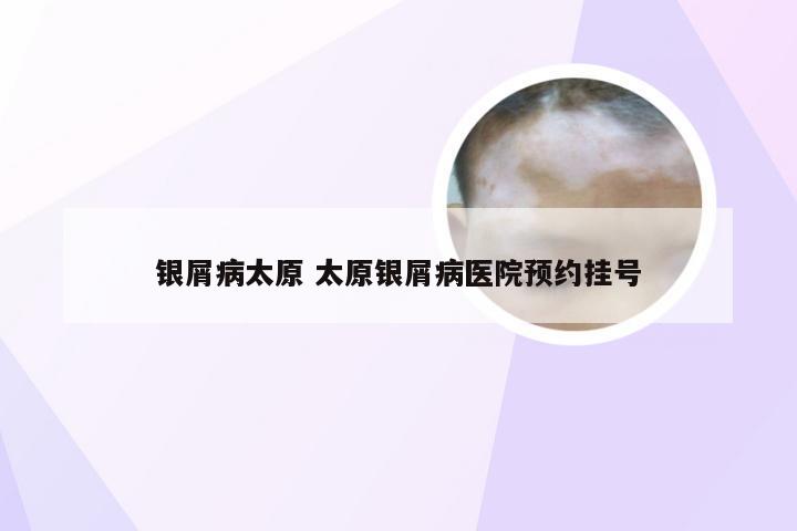 银屑病太原 太原银屑病医院预约挂号