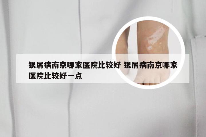银屑病南京哪家医院比较好 银屑病南京哪家医院比较好一点
