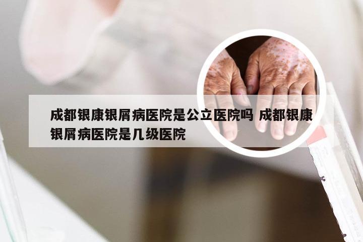 成都银康银屑病医院是公立医院吗 成都银康银屑病医院是几级医院