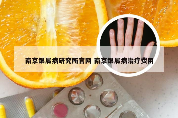 南京银屑病研究所官网 南京银屑病治疗费用